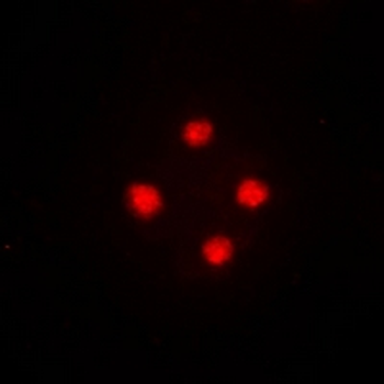 Anti-SRSF5 Antibody