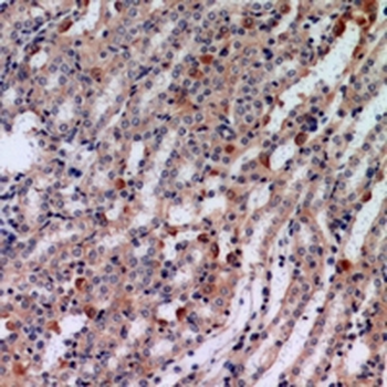 Anti-Tensin 3 Antibody