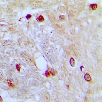Anti-ZNF392 Antibody