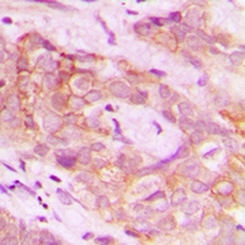 Anti-DUS2L Antibody