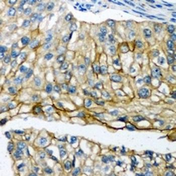 Anti-POTEG Antibody
