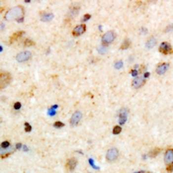 Anti-Girdin Antibody