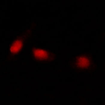Anti-ATRX Antibody