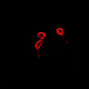 Anti-BLCAP Antibody
