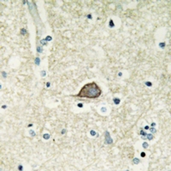 Anti-CELSR3 Antibody