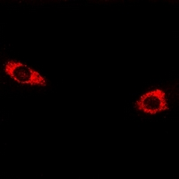 Anti-CELSR3 Antibody