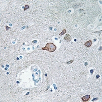 Anti-CEND1 Antibody