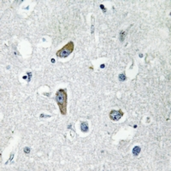 Anti-CDK5RAP2 Antibody