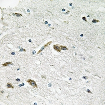 Anti-RPL39L Antibody