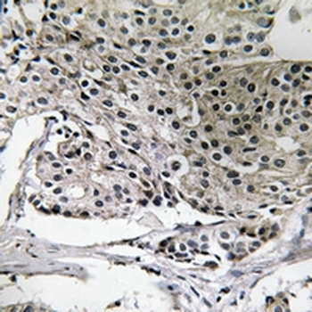 Anti-PIGY Antibody
