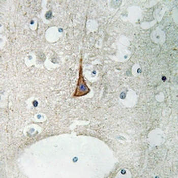 Anti-Nav1.2 Antibody