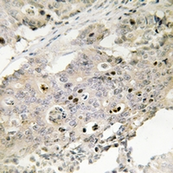 Anti-TAF4 Antibody