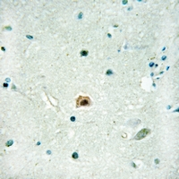 Anti-SOX8 Antibody