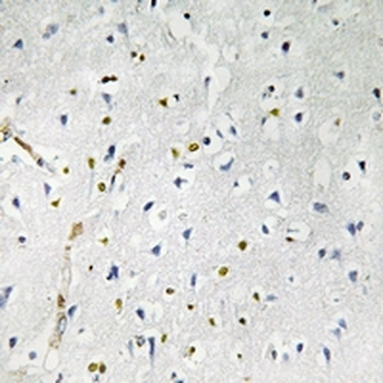 Anti-RhoBTB1 Antibody