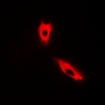 Anti-Cytochrome P450 2C8/9/18/19 Antibody