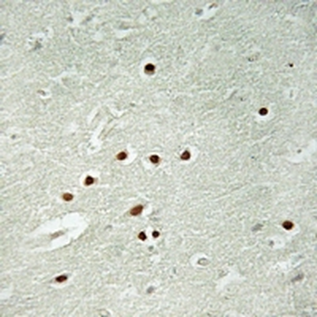 Anti-ANKRD26 Antibody