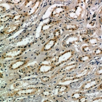 Anti-CD159a/c Antibody