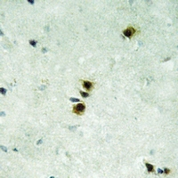 Anti-MXD4 Antibody