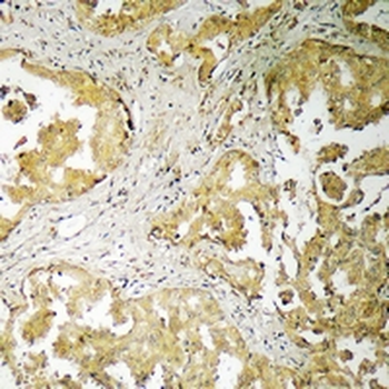 Anti-ADAMTS16 Antibody