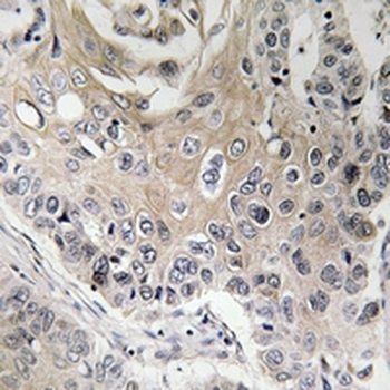 Anti-CCP3 Antibody