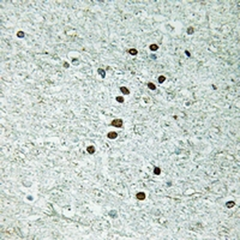 Anti-REXO1 Antibody