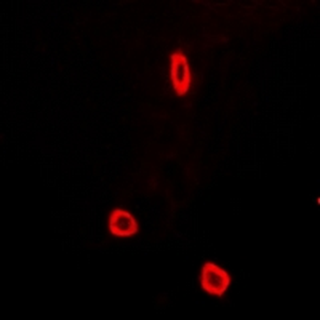 Anti-SCN7A Antibody