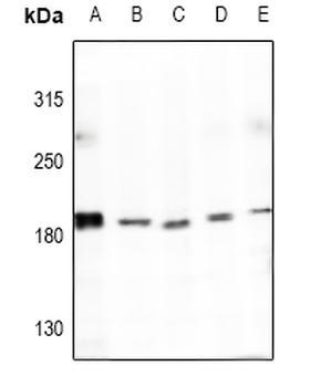 Anti-Collagen 4 alpha 4 Antibody