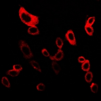 Anti-mPR gamma Antibody