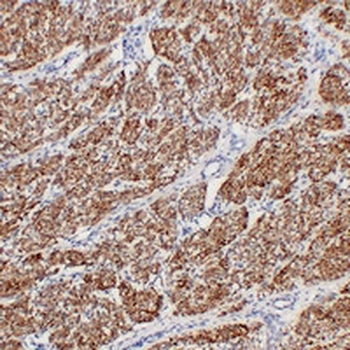 Anti-Actin Muscle Specific Antibody