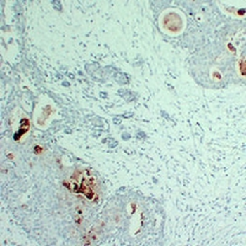 Anti-PIP Antibody
