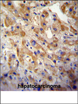 MET/HGFR Antibody
