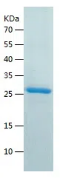 Recombinant Human TSHR Protein ( His tag )