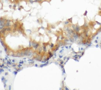 CGAS Antibody