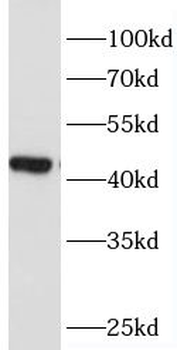 CD69 Rabbit Polyclonal Antibody
