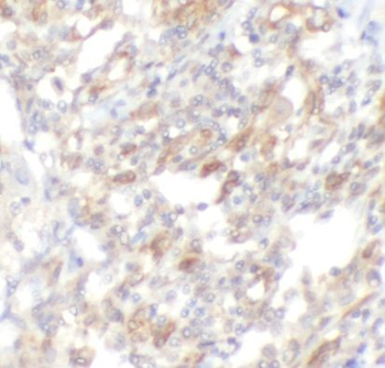 CD4 Mouse Monoclonal Antibody