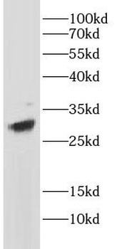 CD8A Mouse Monoclonal Antibody