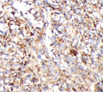 CD8A Mouse Monoclonal Antibody