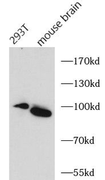 FGFR3 Rabbit Polyclonal Antibody