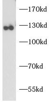 CD22 Rabbit Polyclonal Antibody