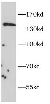 CD163 Rabbit Polyclonal Antibody