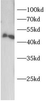 OAS1 Rabbit Polyclonal Antibody