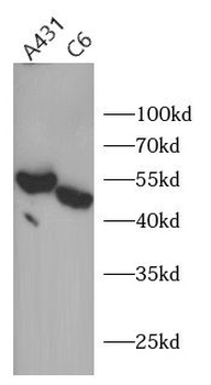 SUFU Rabbit Polyclonal Antibody