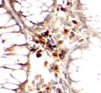 ROBO4 Antibody