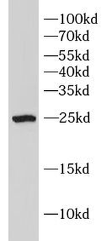 HSD17B10 Rabbit Polyclonal Antibody