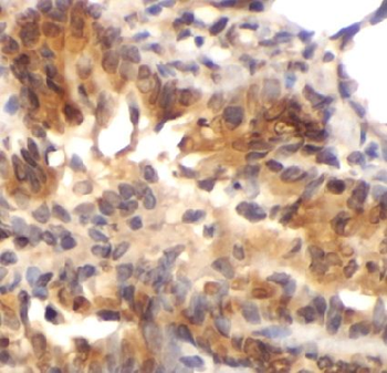 HSD17B10 Rabbit Polyclonal Antibody