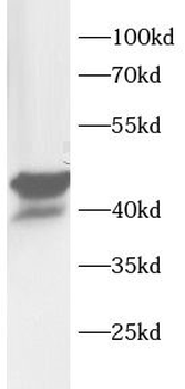 NEIL1 Antibody
