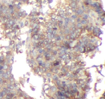 CD36 Antibody