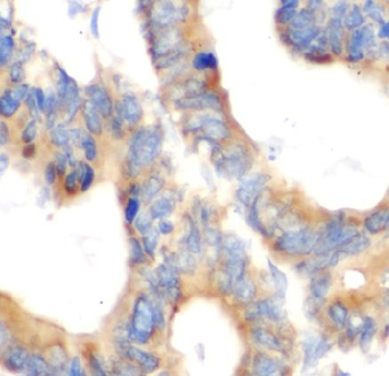 KRT6B Rabbit Polyclonal Antibody