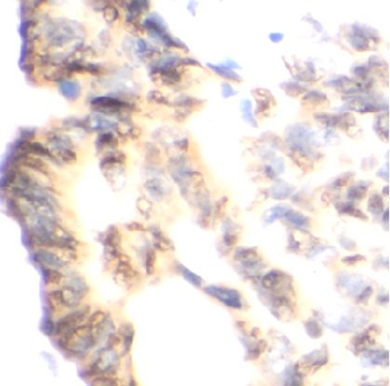 NOS2 Rabbit Polyclonal Antibody