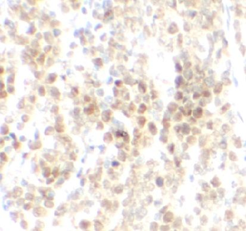 DNMT1 Rabbit Polyclonal Antibody